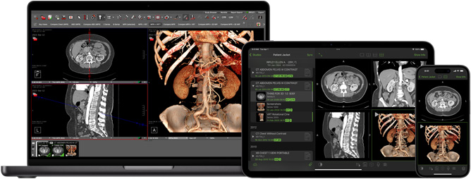 Interface de l’app Visage, utilisée par les radiologues pour interpréter des fichiers de diagnostic volumineux.